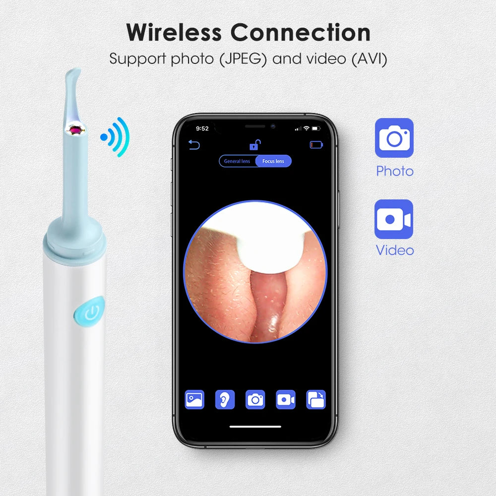 3.9mm Wireless WiFi Ear Pick Otoscope Camera Borescope Luminous Ear Wax Cleaning Teeth Oral Inspection Health Care Ear Cleaning